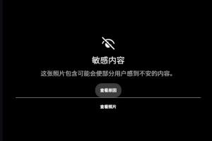 露骨!慎入!范德彪小拇指的骨头直接刺出来了!配图